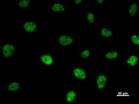 TAFII70 / TAF6 Antibody (clone 585D4a)