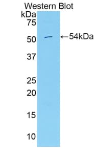 HGFAC / HGFA Antibody (aa104-351)