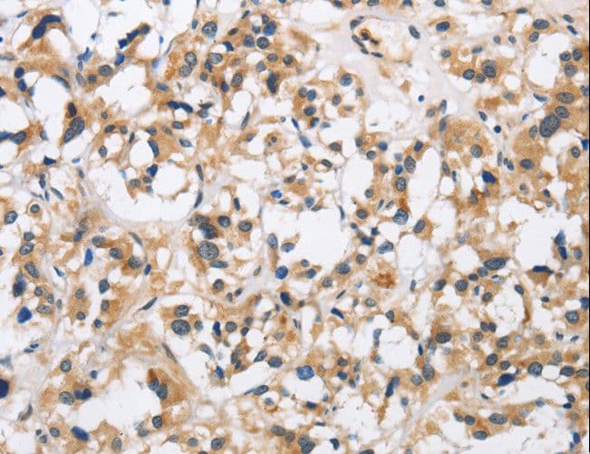 Polyclonal Rabbit anti-Human CKMT2 Antibody (IHC, WB)