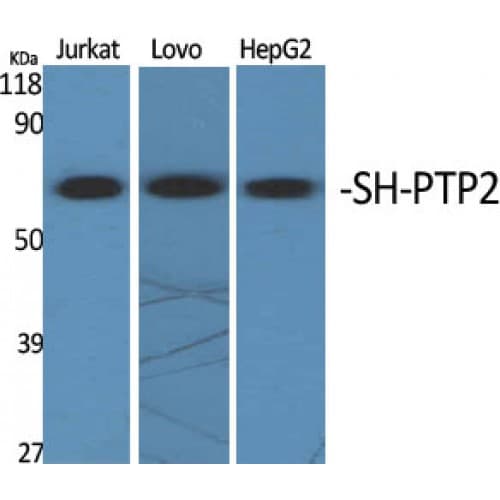 PTPN11 / SHP-2 / NS1 Antibody (290-370 aa, Internal)