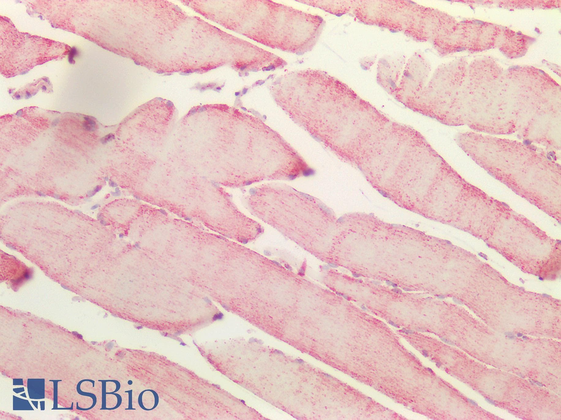 Polyclonal Rabbit anti-Human S100 Protein Antibody (IHC, IF, WB)