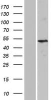 KRT37 / Keratin 37 / KRTHA7 Protein (Over-Expression Lysate Myc-DDK (Flag))