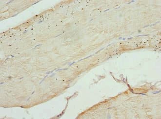 Polyclonal Rabbit anti-Human CFL2 / Cofilin 2 Antibody (IHC, WB)