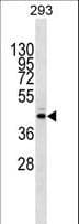 METTL2B Antibody (aa1-30)