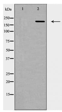TP53BP1 / 53BP1 Antibody