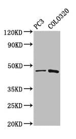 Polyclonal Rabbit anti-Human CAPS2 Antibody (IHC, WB)