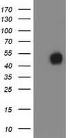 MEF2C Antibody (clone OTI2D2)