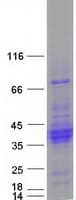 Human C21orf62 Protein (Recombinant Myc-DDK (Flag))