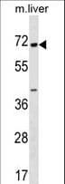 CPNE6 / N-COPINE Antibody (aa138-166)