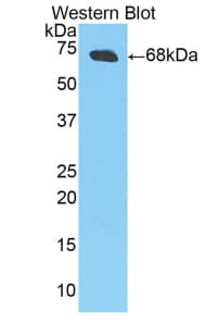 CKM / Creatine Kinase MM Antibody (aa11-367)