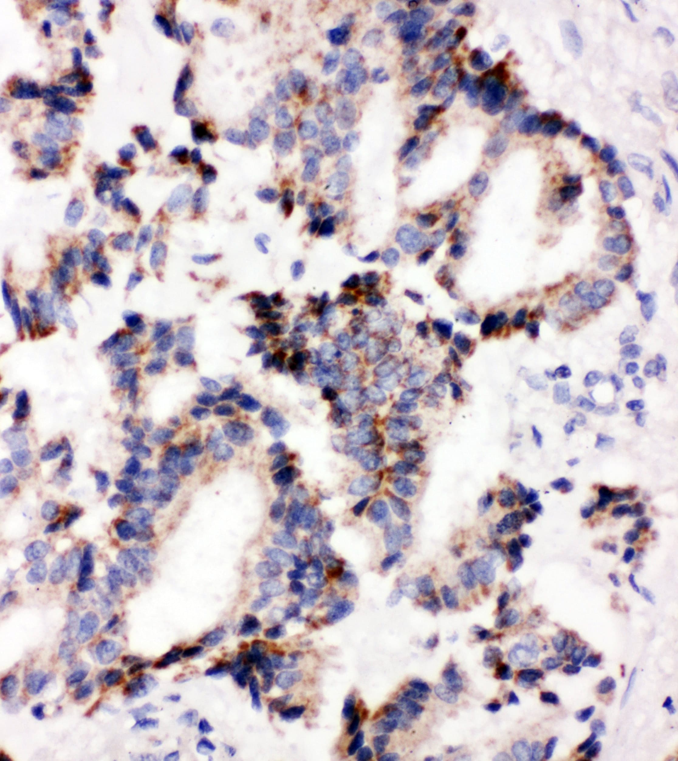 IRAK2 / IRAK-2 Antibody (aa600-616)