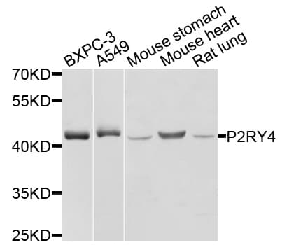 Polyclonal Rabbit anti-Human P2RY4 / P2Y4 Antibody (IHC, WB)