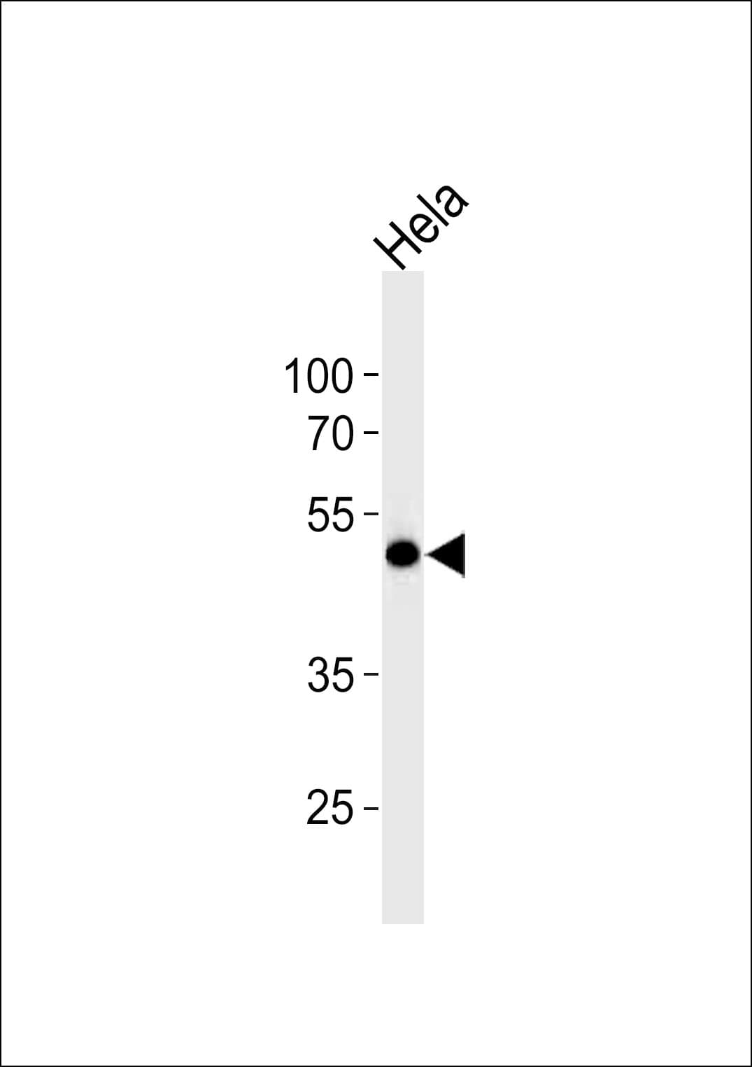 WWTR1 / TAZ Antibody (aa296-330)