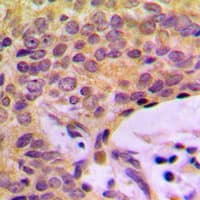 Polyclonal Rabbit anti-Human AGBL2 / CCP2 Antibody (C-Terminus, IHC, WB)