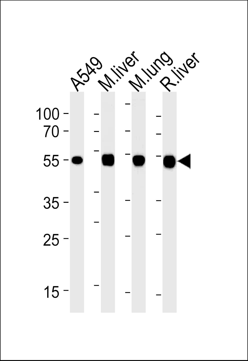 IHC-plus™ ALDH2 Antibody (aa318-347)