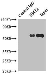 Polyclonal Rabbit anti-Human NMT2 Antibody (IHC, WB)