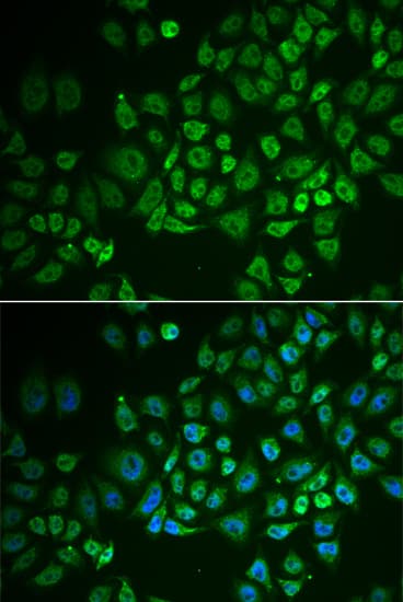GPLD1 / GPIPLD Antibody
