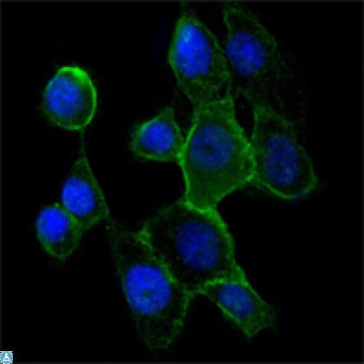 CDH2 / N Cadherin Antibody