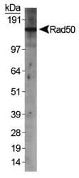 Polyclonal Rabbit anti-Human RAD50 Antibody (C-Terminus, WB)