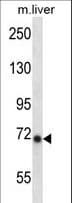 IKBKE / IKKI / IKKE Antibody (aa470-498)