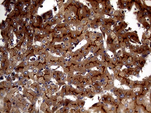 ABCB1 / MDR1 / P Glycoprotein Antibody (aa995-1280, clone OTI2H2)