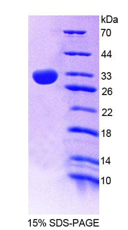 Mouse SPR Protein (Recombinant His-T7)