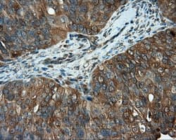 PIM2 / Pim-2 Antibody (clone OTI10A12)