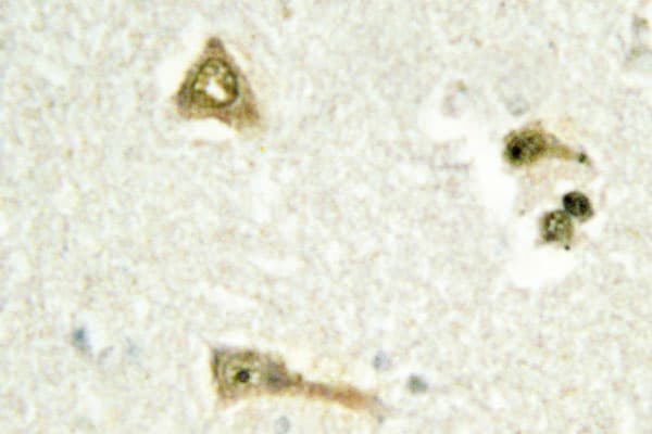 Polyclonal Rabbit anti-Human TSC22D1 / TSC22 Antibody (Glu73, IHC, IF, WB)