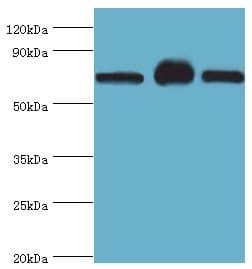 SLC25A13 / CITRIN Antibody (aa1-300)