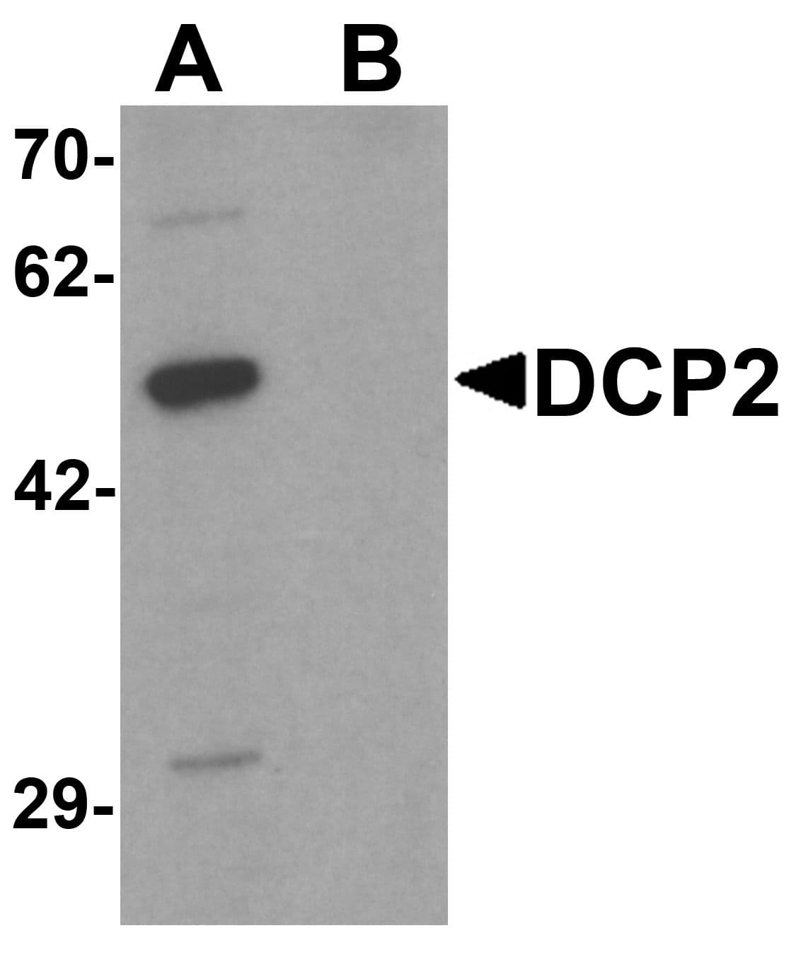 IHC-plus™ Polyclonal Rabbit anti-Human DCP2 Antibody (IHC, IF, WB)
