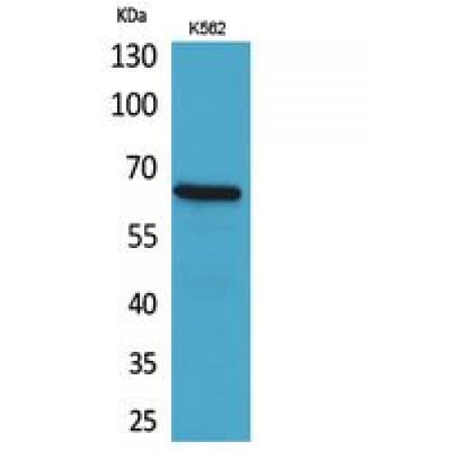 ALCAM / CD166 Antibody (481-530 aa, C-terminal)
