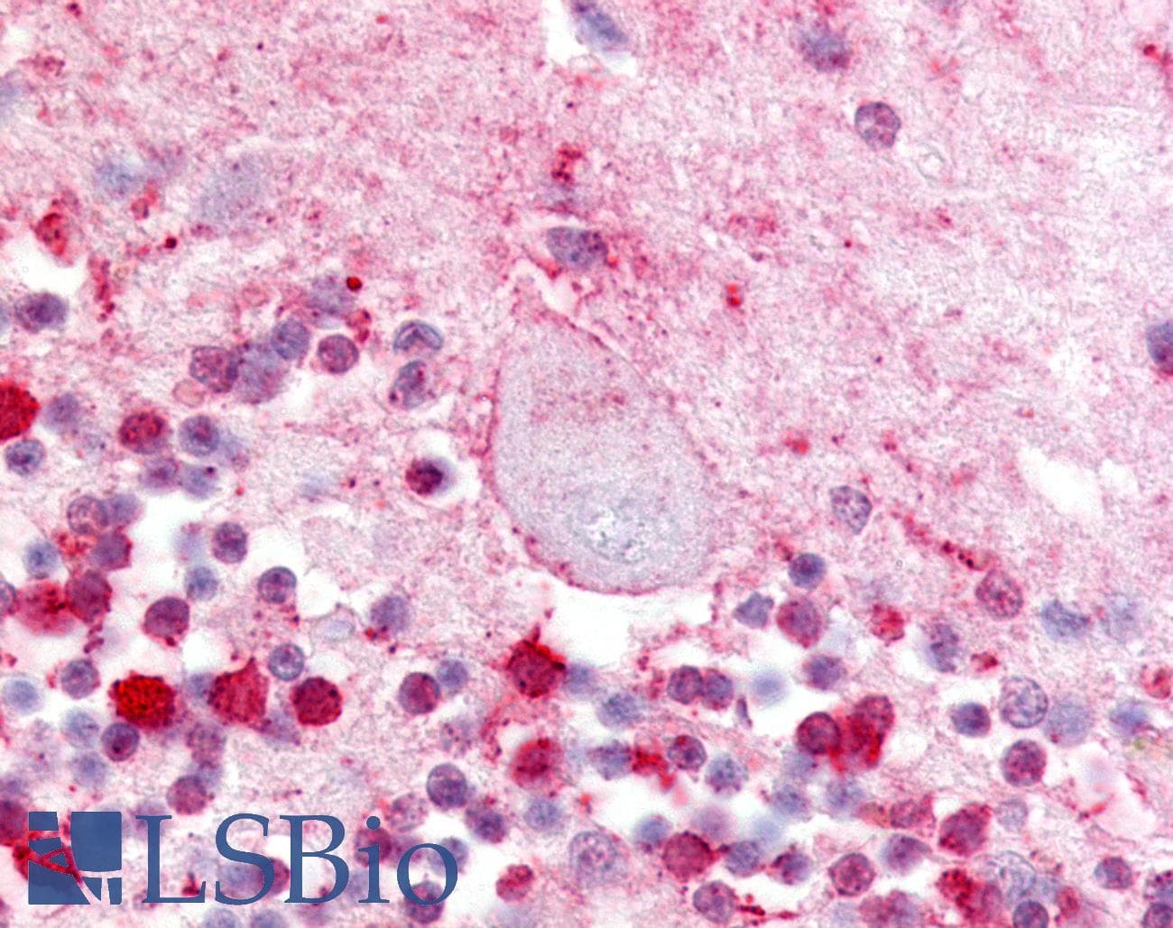 IHC-plus™ LPAR5 / GPR92 Antibody (Extracellular Domain)