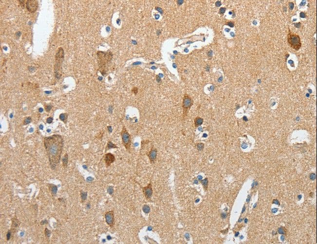 RCAN1 / DSCR1 Antibody