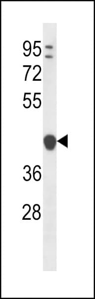 YIPF1 Antibody (aa34-63)