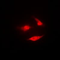 PSMB2 Antibody