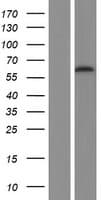 PIP5K1A Protein (Over-Expression Lysate Myc-DDK (Flag))
