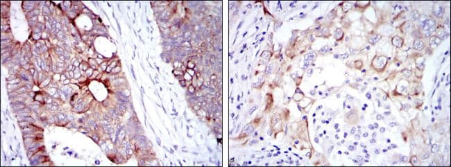 KRT19 / CK19 / Cytokeratin 19 Antibody (clone 1H6)