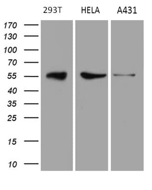 Monoclonal Mouse anti-Human RAB3IP / RABIN3 Antibody (clone OTI4A7, WB)