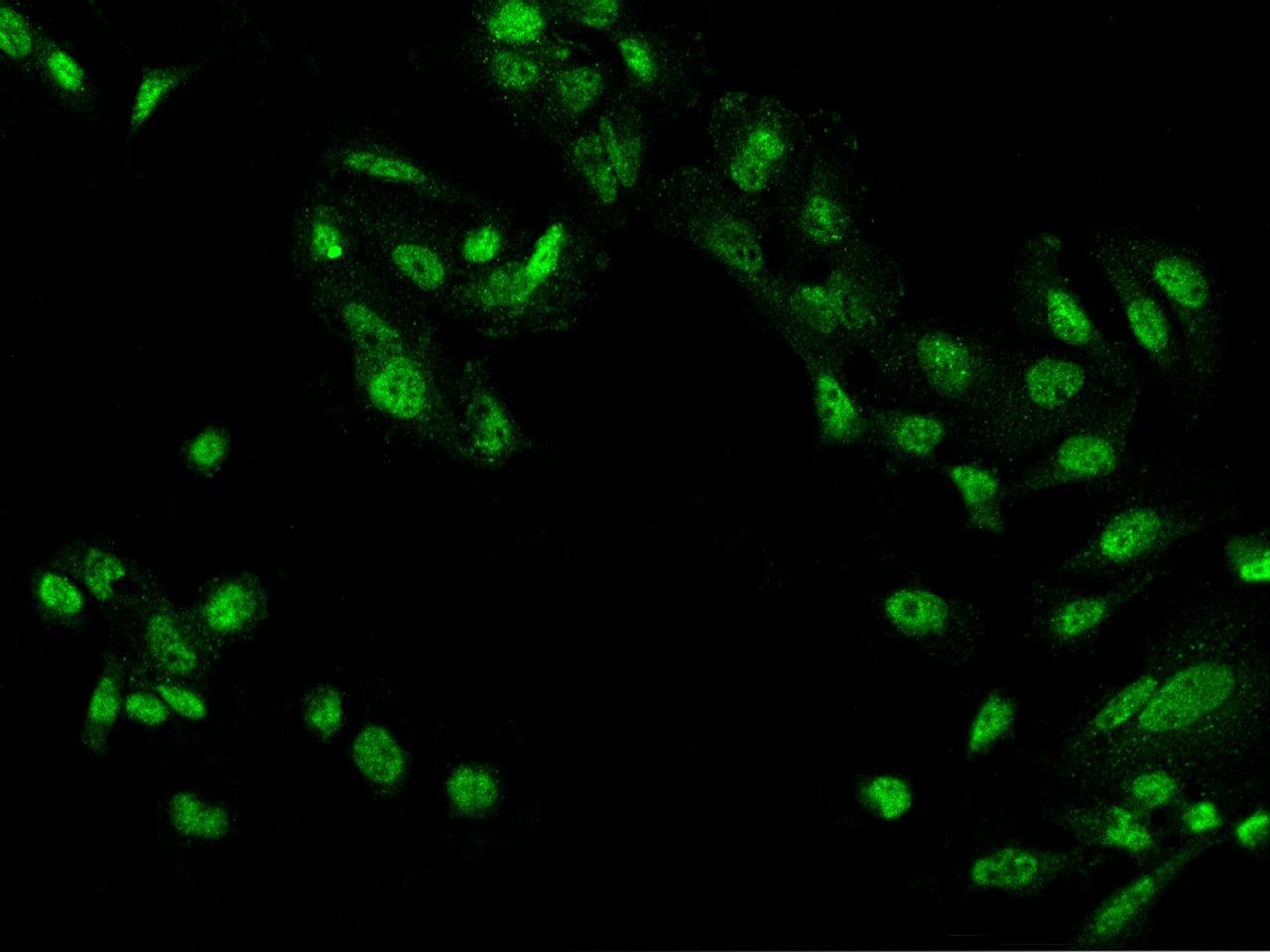 Polyclonal Rabbit anti-Human ZBTB20 Antibody (IF)