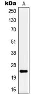 KCNMB4 Antibody (Internal)