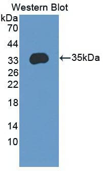 ENPP2 / Autotaxin Antibody (clone A9, APC)