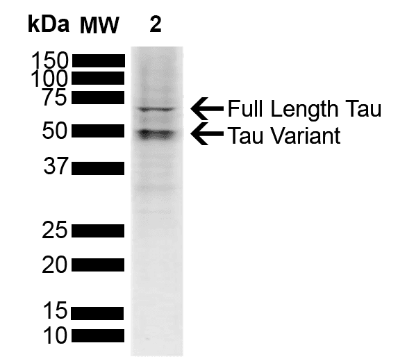 PathPlus™ Polyclonal Rabbit anti-Human MAPT / Tau Antibody (IHC, WB)