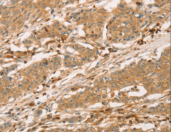 SPN / CD43 Antibody
