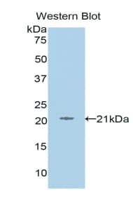 L1CAM Antibody (aa526-690, APC)