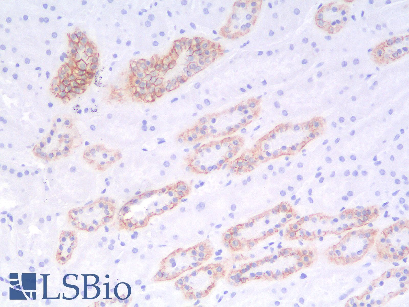 IHC-plus™ Recombinant Monoclonal Rabbit anti-Human CDH1 / E Cadherin Antibody (clone CDH1/2208R, IHC, IF, WB)