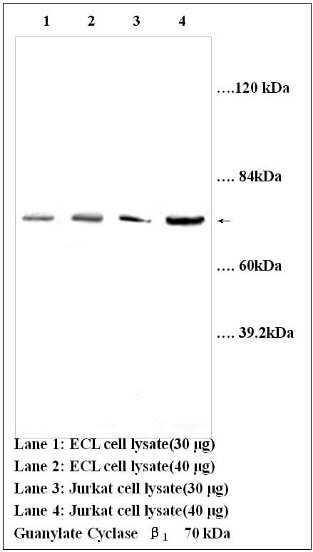 Polyclonal Rabbit anti-Rat GUCY1B3 Antibody (aa188-207, WB)