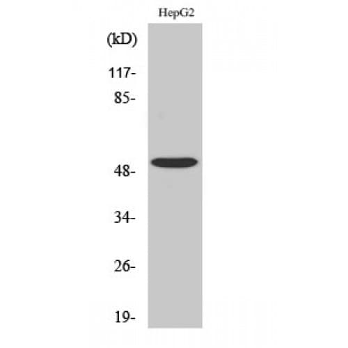 TGFBR1 / ALK5 Antibody (100-180 aa)