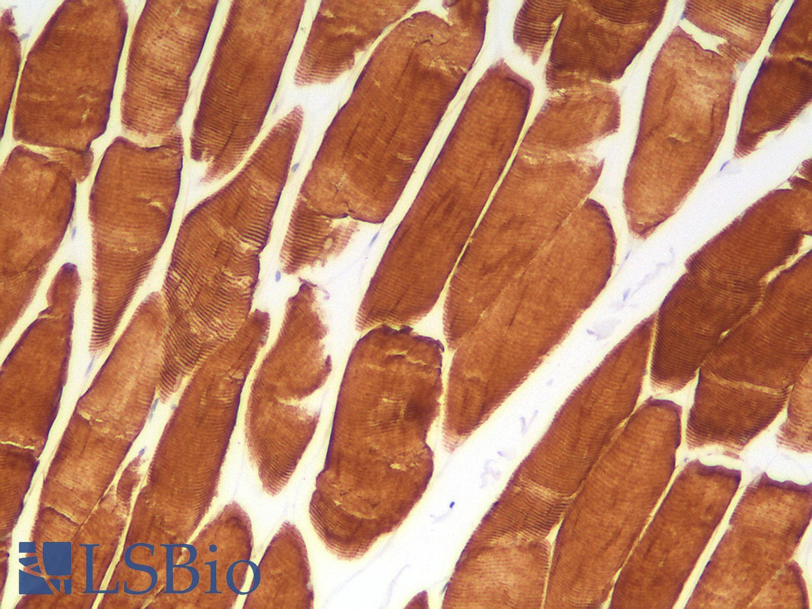 PathPlus™ DES / Desmin Antibody (clone DES/2960R)