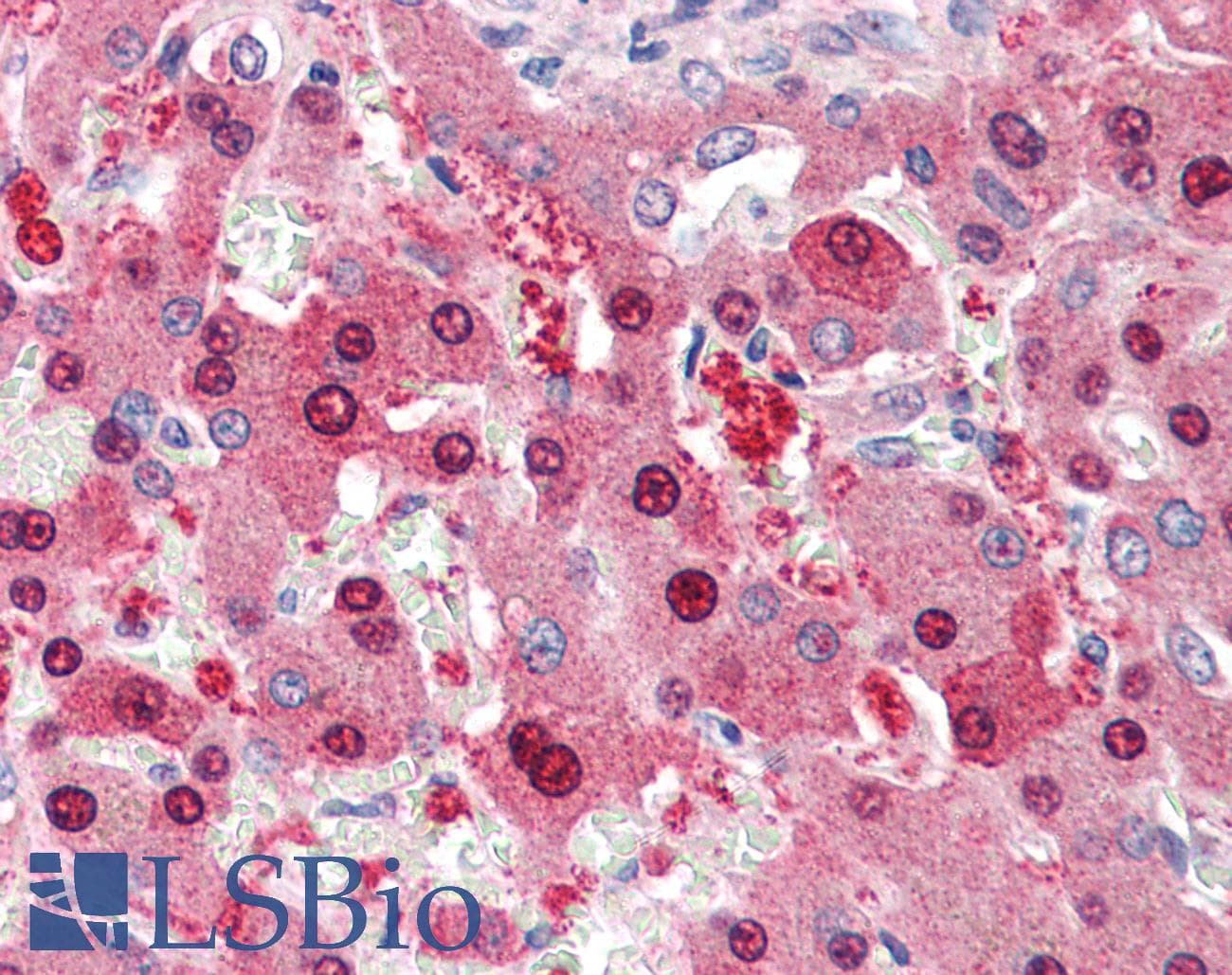 IHC-plus™ HEC1 / NDC80 Antibody (aa630-642)