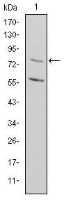 Monoclonal Mouse anti-Human MTHFR Antibody (clone 5D3, IHC, WB)